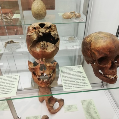 Tentoongestelde schedels